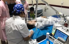 疤痕治療儀器多少錢一臺？點陣激光設備價格_二氧化碳點陣激光儀器