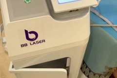 BB laser素顏光國內(nèi)哪個生產(chǎn)廠家比較好？進(jìn)口素顏光設(shè)備代理商